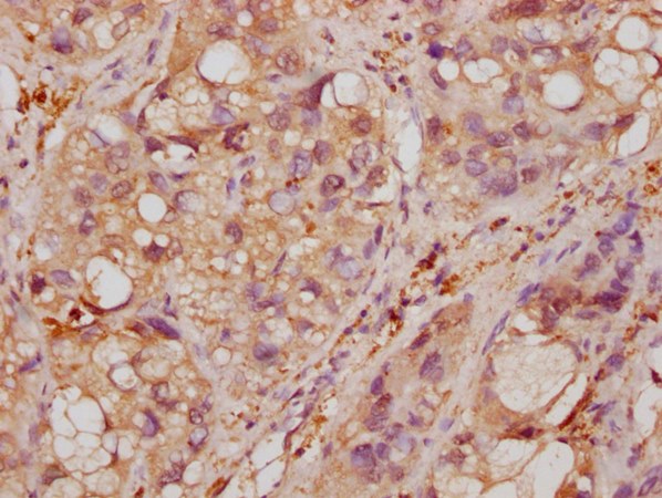 ENO1 Monoclonal Antibody