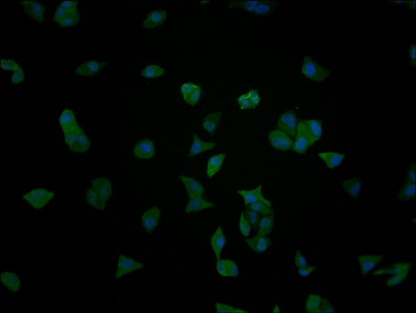 ENO1 Monoclonal Antibody