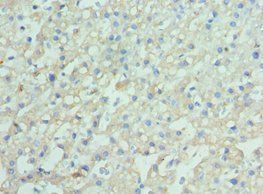 ENPP2 Antibody