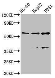 ENTPD1 Antibody