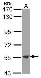 ENTPD3 antibody [N3C3]