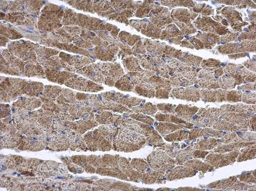 ENTPD6 Rabbit Polyclonal Antibody