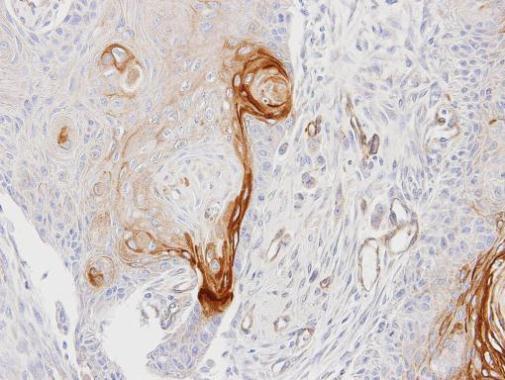 ENTPD6 Rabbit Polyclonal Antibody
