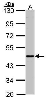 ENTPD6 Rabbit Polyclonal Antibody