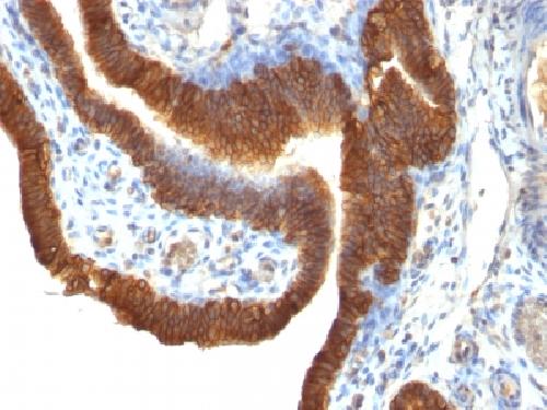 Ep-CAM / CD326 (Extracellular Domain) (Epithelial Marker) Antibody