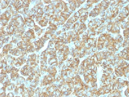 Recombinant EpCAM / CD326 (Epithelial Marker) Antibody