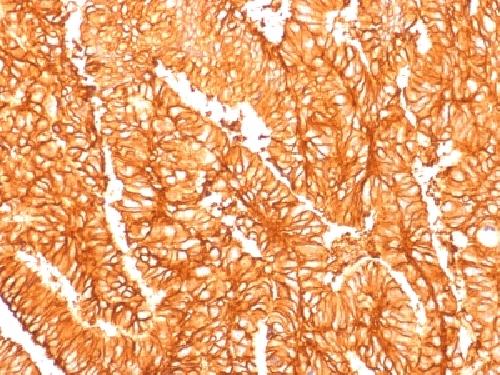Recombinant Ep-CAM / CD326 (Extracellular Domain) (Epithelial Marker) Antibody