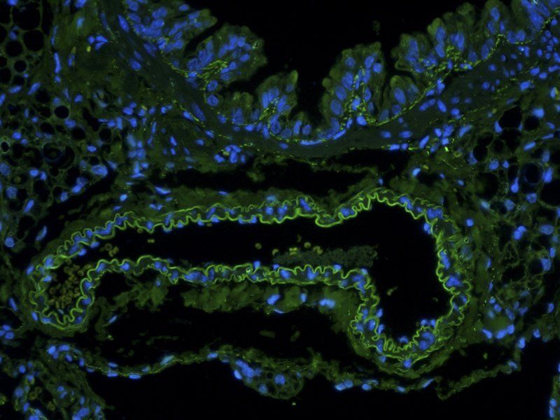 EpCAM Rabbit Polyclonal Antibody (FITC)