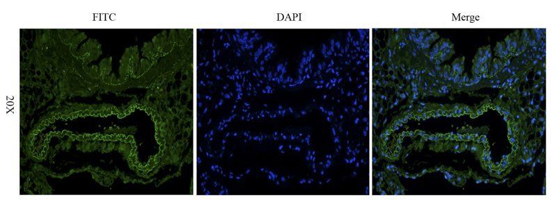 EpCAM Rabbit Polyclonal Antibody (FITC)