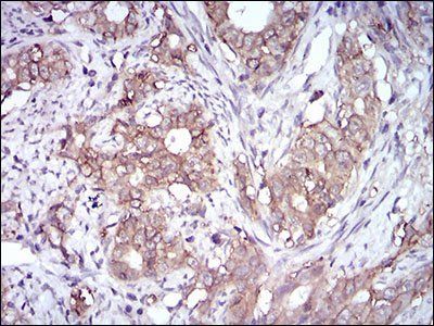 EPCAM Antibody