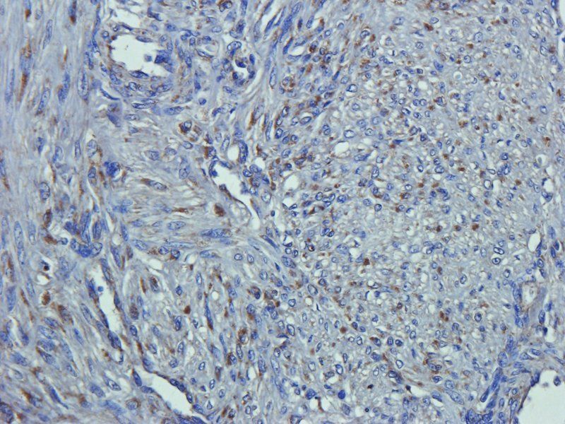 EpCAM Rabbit Polyclonal Antibody