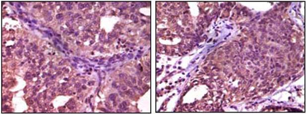 EphA1 Antibody