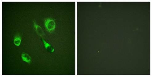 EPHA2/3 (Phospho-Tyr588/596) Antibody