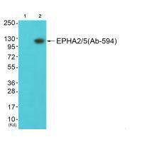 EPHA2/EPHA5 Antibody