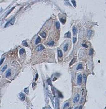 EPHA7 Rabbit Polyclonal Antibody