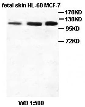 EPHA7 Rabbit Polyclonal Antibody