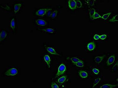 EPHB2 Antibody