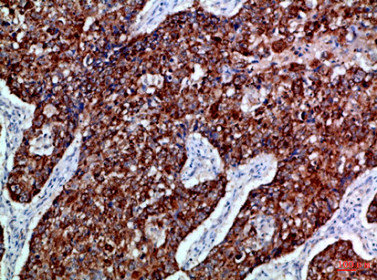 EPHB3 Antibody
