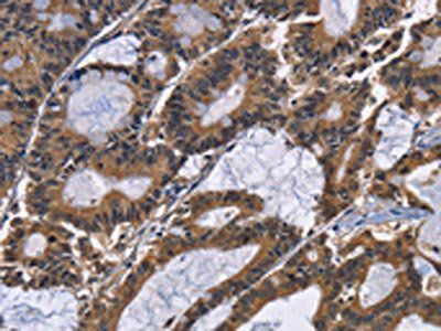 EPHB6 Antibody