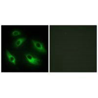 EPHB6 Antibody