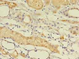 EPHX2 Antibody