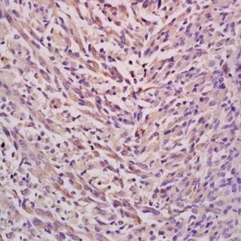 EPHX2 Rabbit Polyclonal Antibody