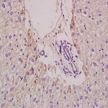 EPHX2 Rabbit Polyclonal Antibody