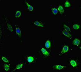 EPM2A Antibody