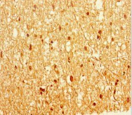 EPM2A Antibody