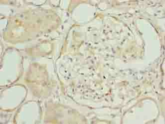 EPM2AIP1 Antibody
