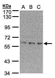 EPM2AIP1 Rabbit Polyclonal Antibody