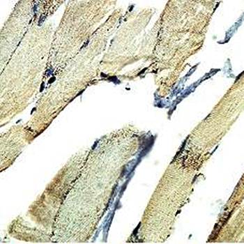 EPM2AIP1 Rabbit Polyclonal Antibody
