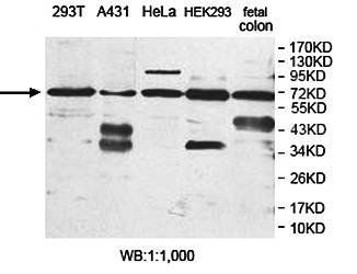 EPM2AIP1 Rabbit Polyclonal Antibody