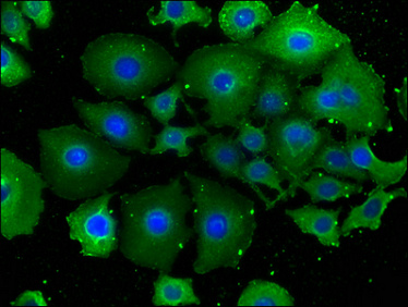 EPN2 Antibody