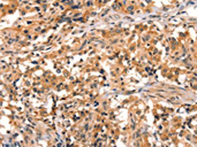EPPIN Antibody