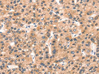 EPPIN Antibody