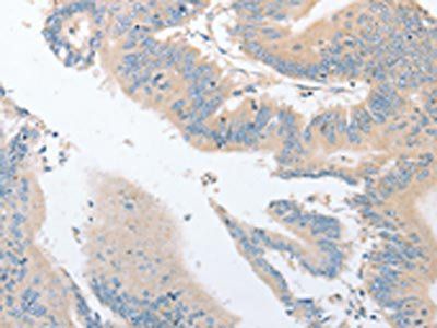 EPS15L1 Antibody