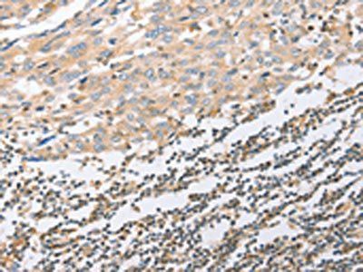 EPS15L1 Antibody