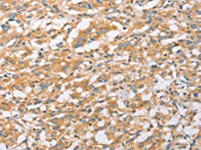 EPS15L1 Antibody