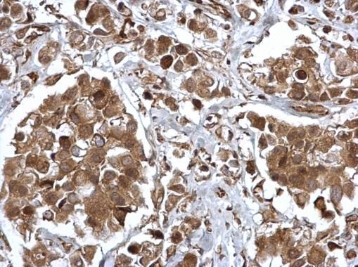 EPS8 Rabbit Polyclonal Antibody