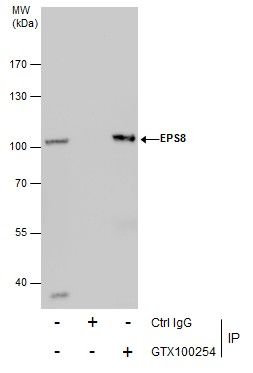 EPS8 Rabbit Polyclonal Antibody