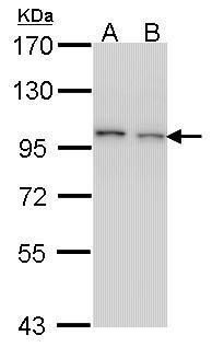 EPS8 Rabbit Polyclonal Antibody