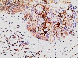 EPS8 Antibody