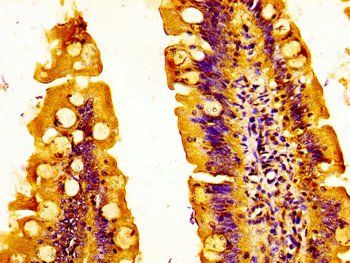 EPS8L3 Antibody