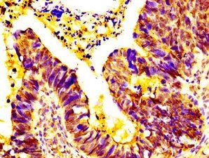 EPS8L3 Antibody