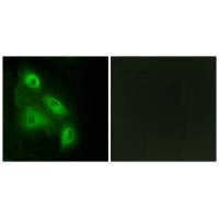 EPS8L3 Antibody