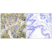 EPS8L3 Antibody