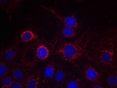 ERBB2 Antibody