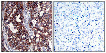 ERBB2 Antibody
