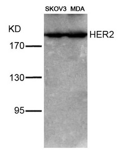 ERBB2 Antibody